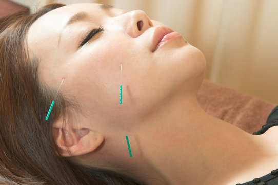 顔の若返りを鍼灸で実現する新しい美容法