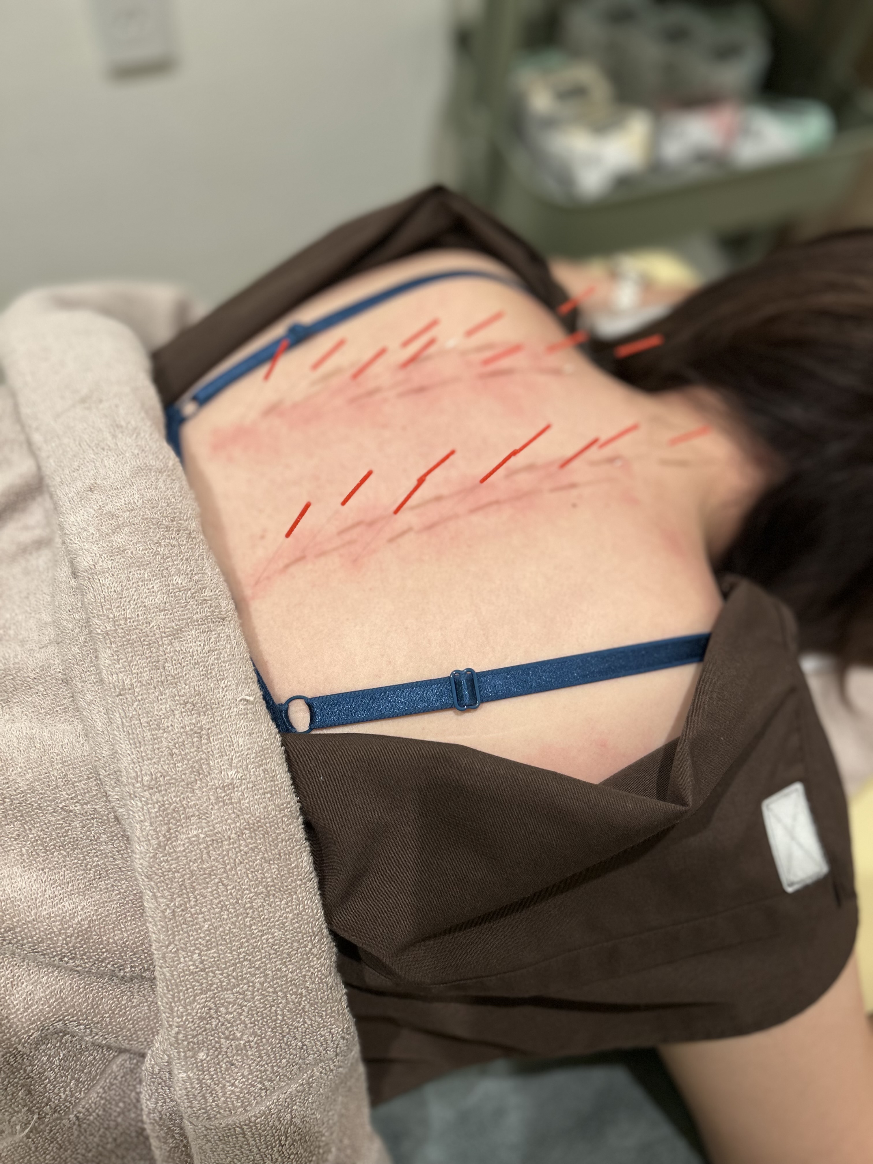 専門的な施術の重要性